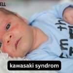 Kawasaki-Syndrom